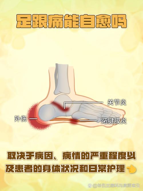 经常腰痛的人要看看脚!病根可能在这里!缓解方法在文内