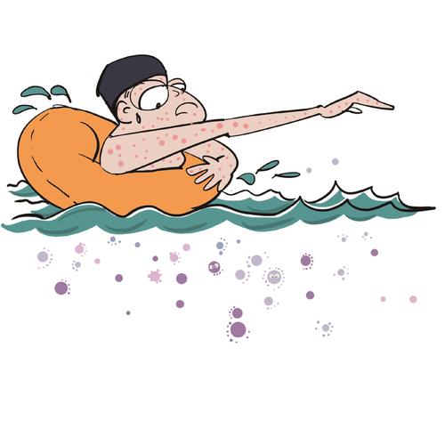 警惕这些“泳池病” 夏日戏水正确打开方式快收藏