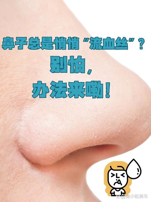 鼻腔出血莫惊慌