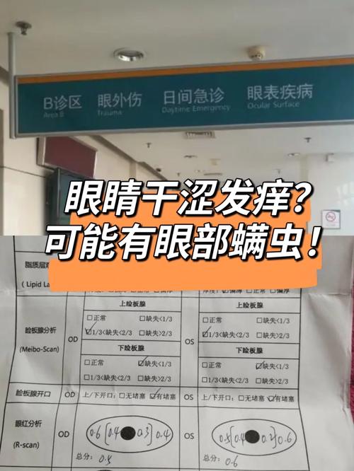 老人眼睛瘙痒难耐竟是虱虫寄生眼睑,孙女也感染了!医生提醒