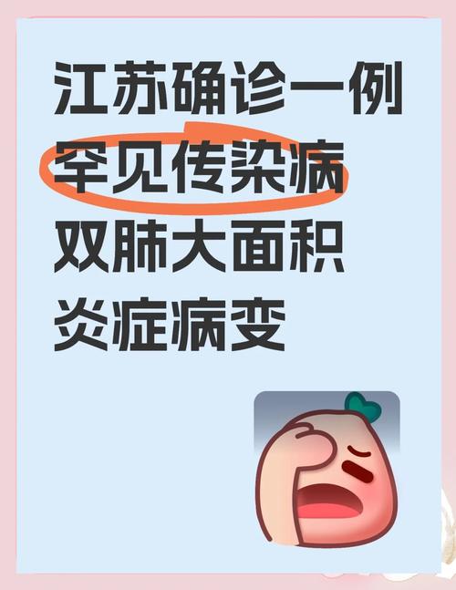持续高热、头痛、全身酸痛,江苏确诊一例罕见传染病