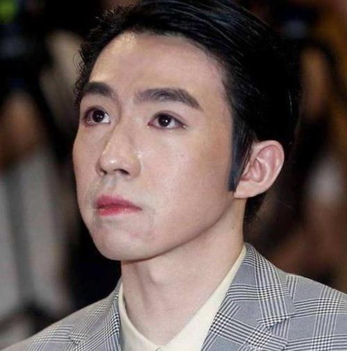 知名男星突发意外，脸部烧伤！这些细节要特别注意
